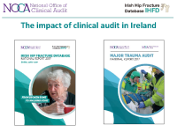 The Impact of Clinical Audit in Ireland - Louise Brent front page preview
              