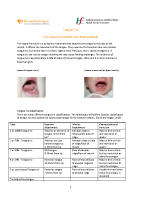 Tongue tie - Factsheet for Healthcare Professionals front page preview
              