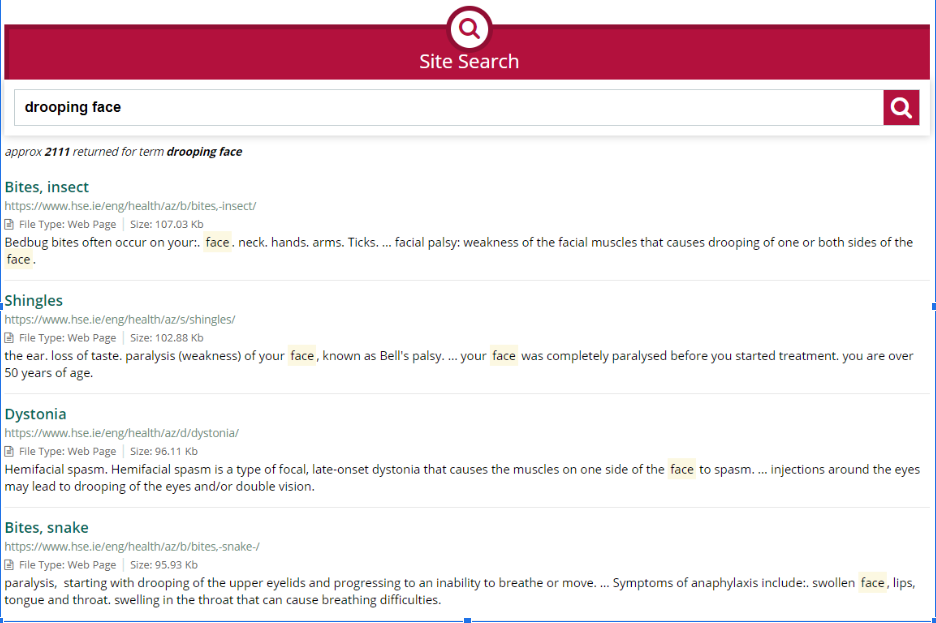 Screenshot of search results page after a user searched for information about drooping face Screenshot of search results page after a user searched for information about drooping face