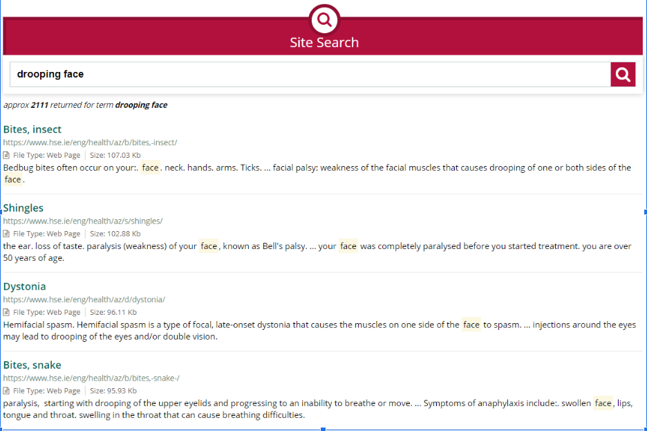 Screenshot of search results page after a user searched for information about drooping face