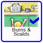 Burns and Scalds Burns and Scalds