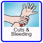 Cuts and Bleeding Cuts and Bleeding