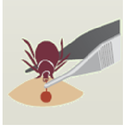 Illustration of a tick infecting.
