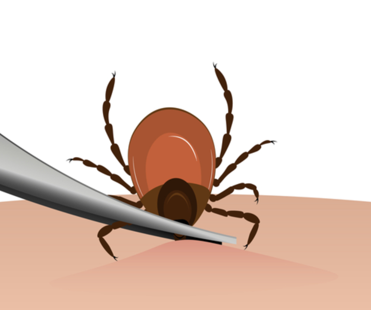 tick2 tick2