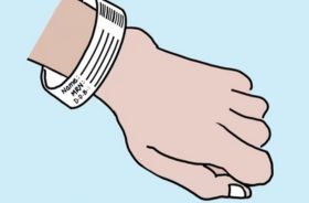 An illustration of a hand with an identification tag around the wrist.
